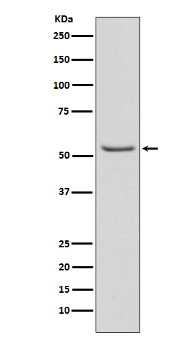 WB - Anti-Phospho-Smad3 (S423 + S425) Rabbit Monoclonal Antibody ABO13199